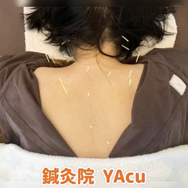 鍼灸院YAcu　ｰ白楽ｰ【TikTokあります】